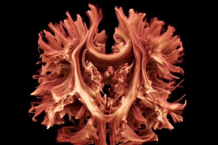 Image for The most detailed ever scan of the wiring of the human brain has been produced