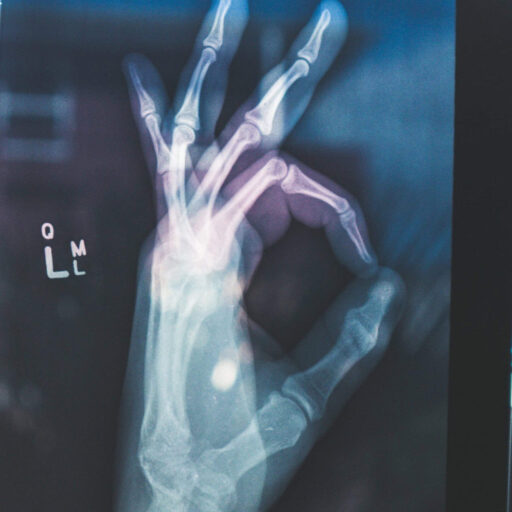 New ‘bandage’ helps rebuild broken bones