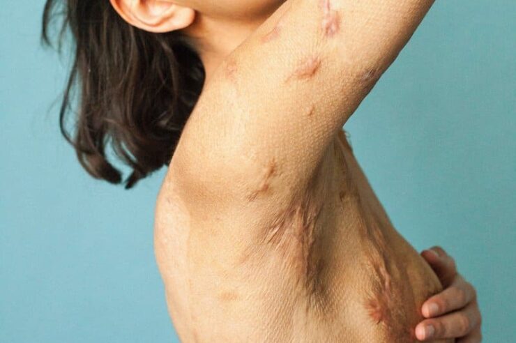 Image for For every scar, a story
